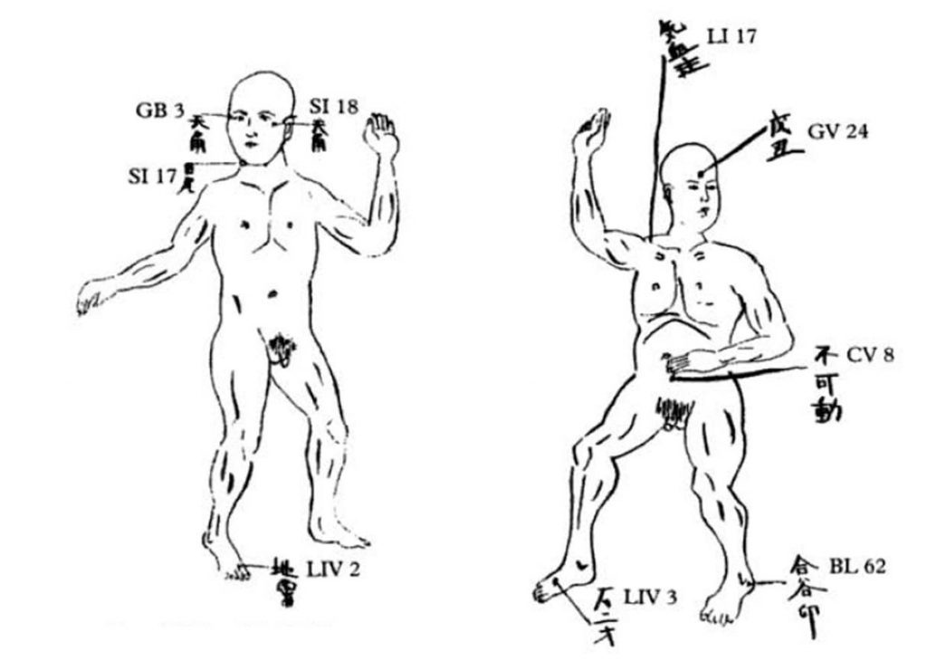 Diagrama con algunos de los puntos vitales del cuerpo humano